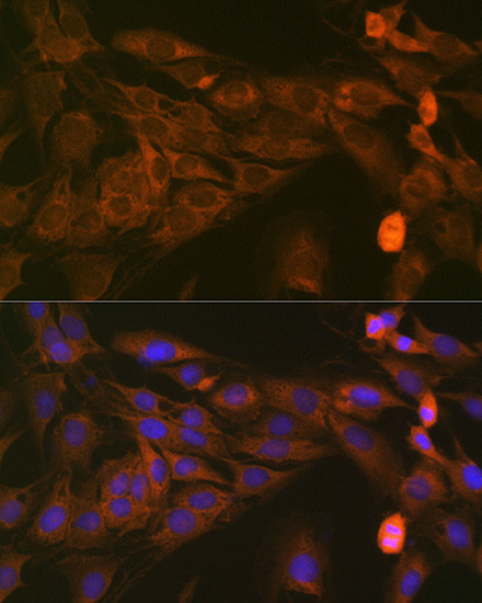 STAT4 Antibody in Immunocytochemistry (ICC/IF)