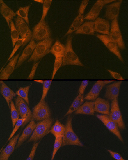 STAT4 Antibody in Immunocytochemistry (ICC/IF)