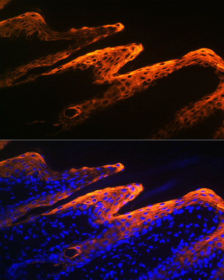 Cytokeratin 10 Antibody in Immunohistochemistry (Paraffin) (IHC (P))