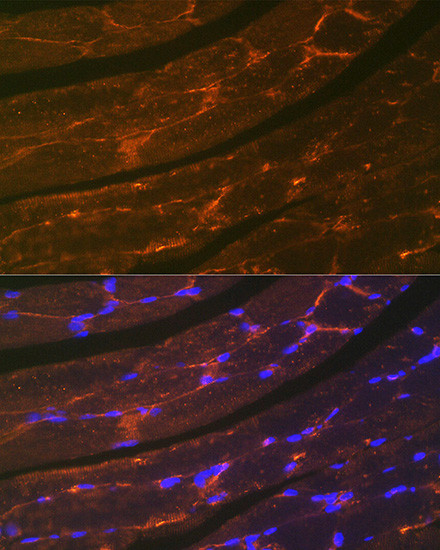 Dystrophin Antibody in Immunocytochemistry (ICC/IF)