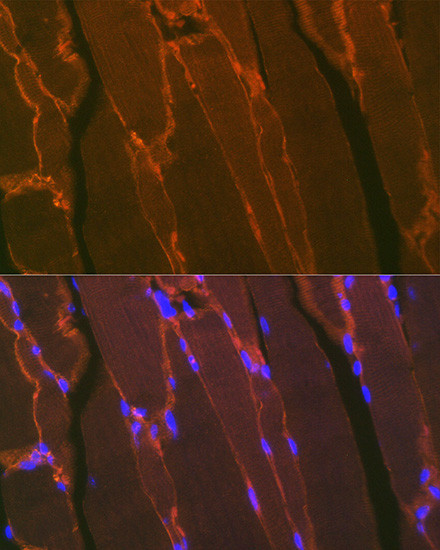 Dystrophin Antibody in Immunocytochemistry (ICC/IF)