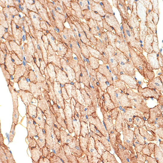 Caveolin 3 Antibody in Immunohistochemistry (Paraffin) (IHC (P))