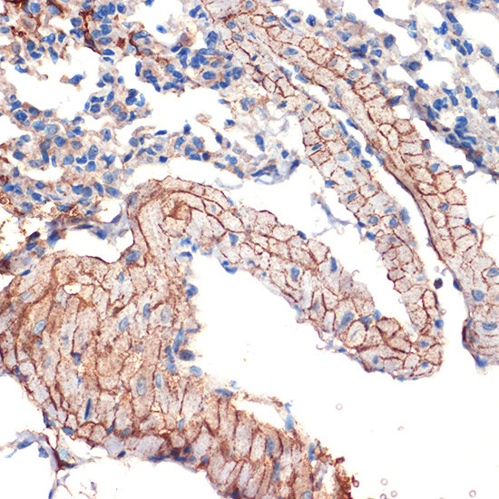 Caveolin 3 Antibody in Immunohistochemistry (Paraffin) (IHC (P))