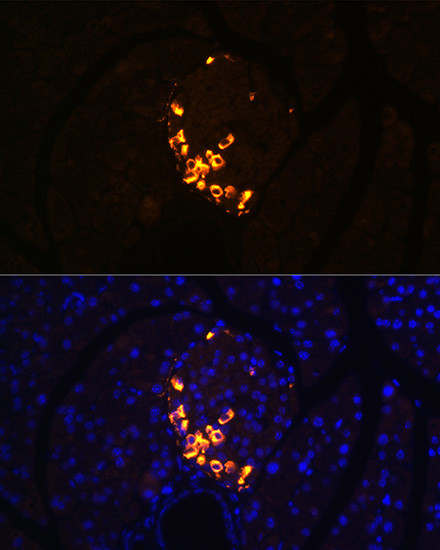 GLP-2 Antibody in Immunohistochemistry (Paraffin) (IHC (P))