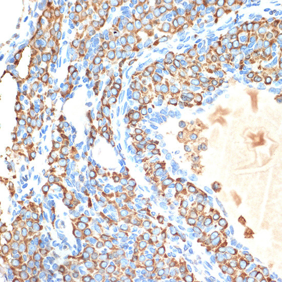 Cytochrome P450 Reductase Antibody in Immunohistochemistry (Paraffin) (IHC (P))