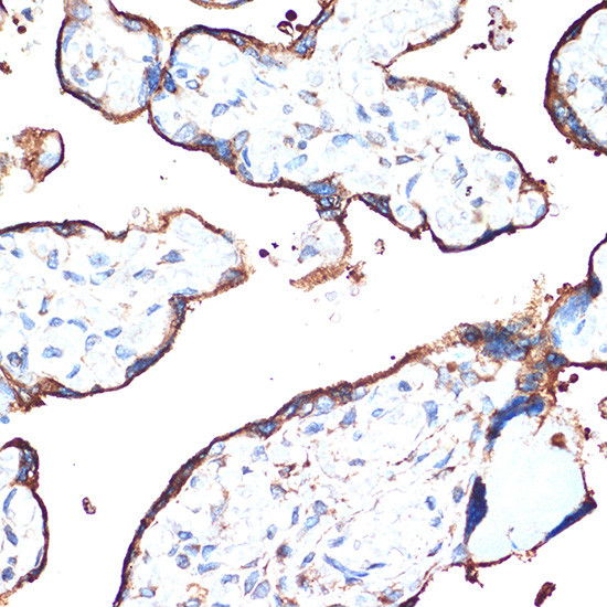 Cytochrome P450 Reductase Antibody in Immunohistochemistry (Paraffin) (IHC (P))