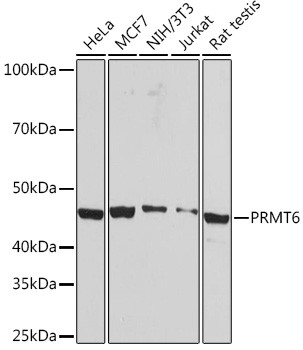 PRMT6 Antibody in Western Blot (WB)