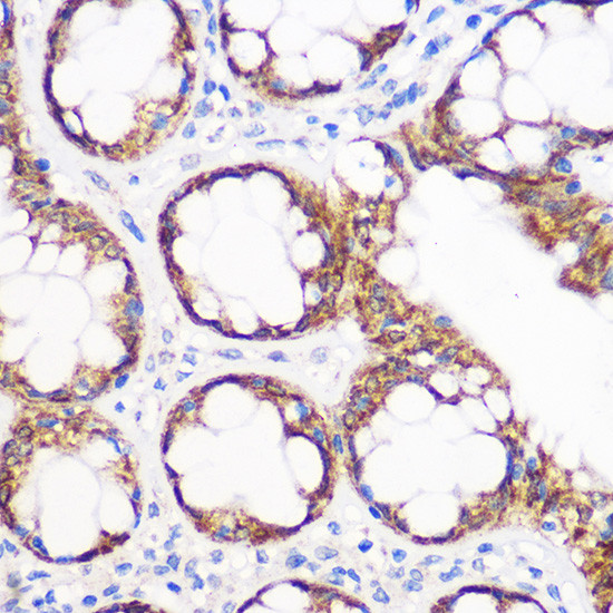 IGF2BP2 Antibody in Immunohistochemistry (Paraffin) (IHC (P))