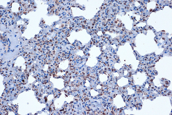 JunD Antibody in Immunohistochemistry (Paraffin) (IHC (P))