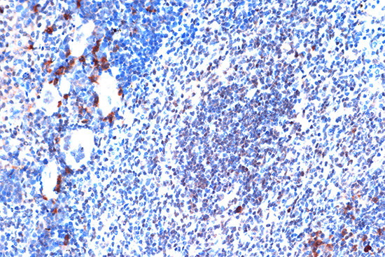 JunD Antibody in Immunohistochemistry (Paraffin) (IHC (P))