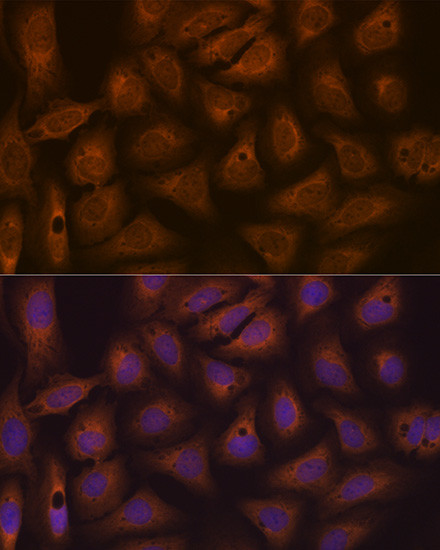 CAD Antibody in Immunocytochemistry (ICC/IF)