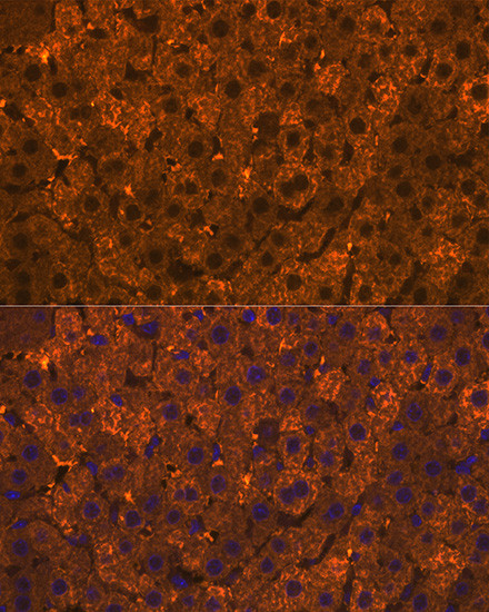 SULT2A1 Antibody in Immunohistochemistry (Paraffin) (IHC (P))