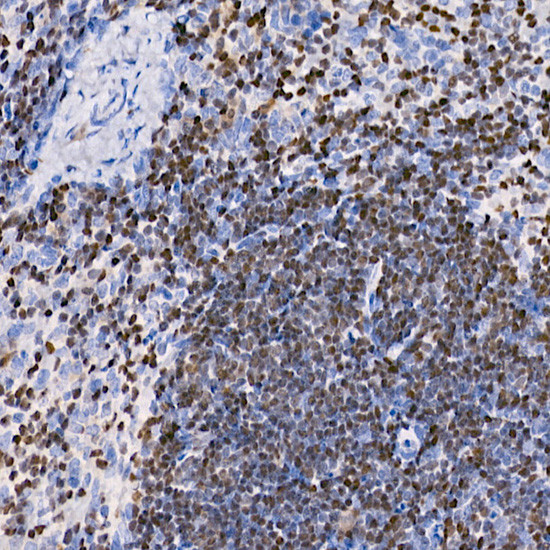 IKZF3 Antibody in Immunohistochemistry (Paraffin) (IHC (P))