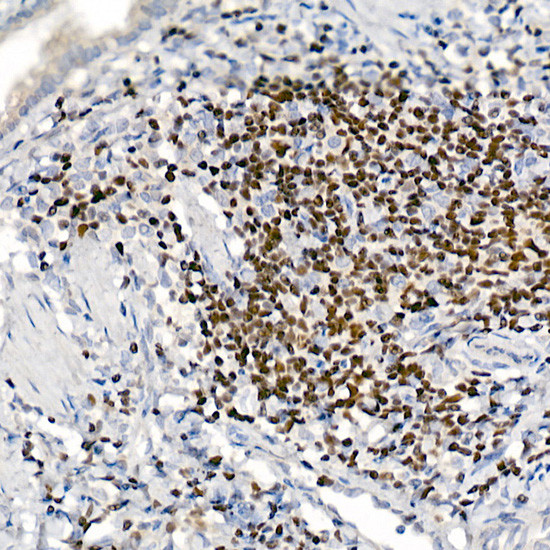 IKZF3 Antibody in Immunohistochemistry (Paraffin) (IHC (P))