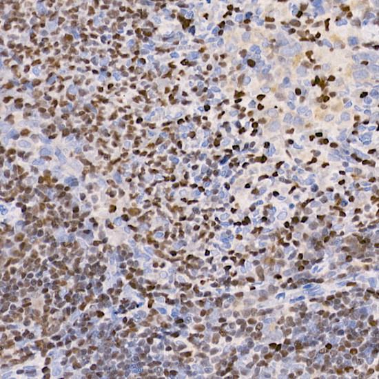 IKZF3 Antibody in Immunohistochemistry (Paraffin) (IHC (P))