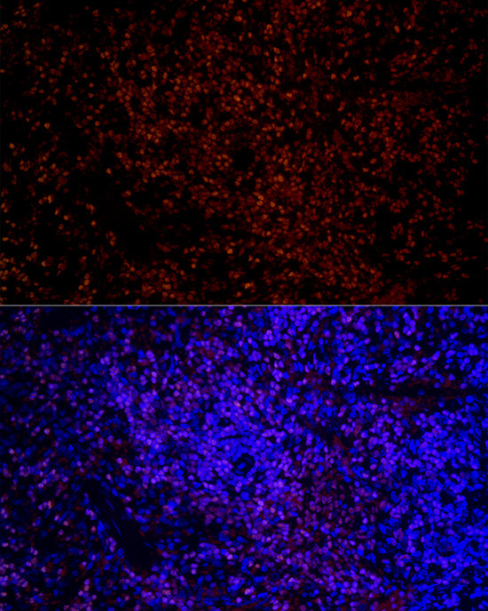 IKZF3 Antibody in Immunohistochemistry (Paraffin) (IHC (P))