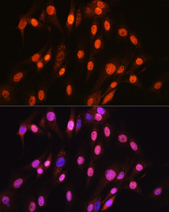 SOX10 Antibody in Immunocytochemistry (ICC/IF)