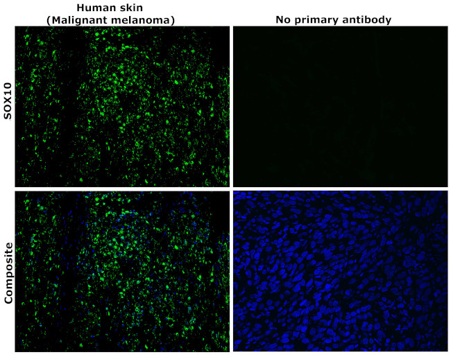 SOX10 Antibody in Immunohistochemistry (Paraffin) (IHC (P))