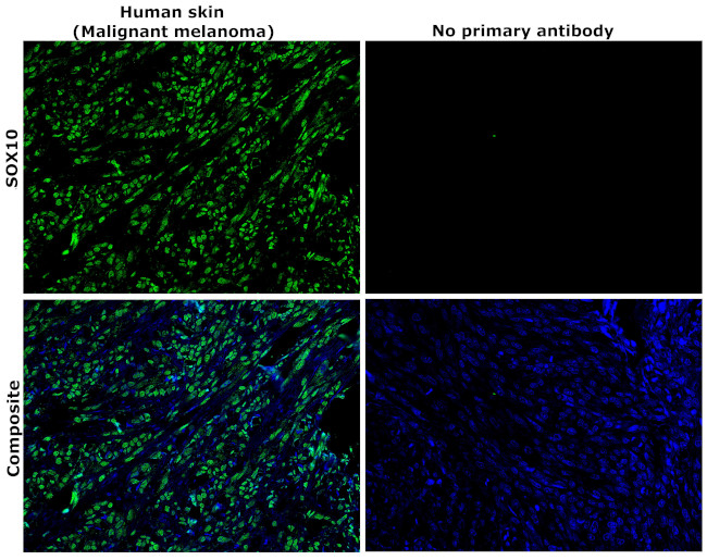 SOX10 Antibody in Immunohistochemistry (Paraffin) (IHC (P))