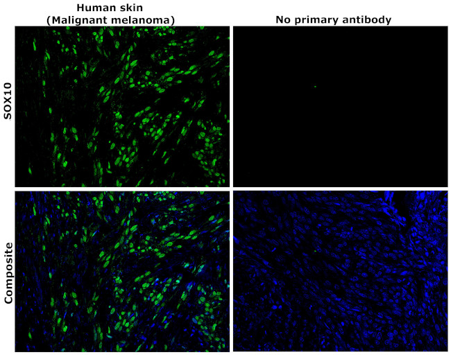 SOX10 Antibody in Immunohistochemistry (Paraffin) (IHC (P))