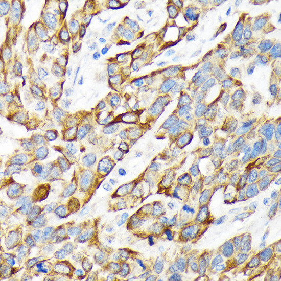 Cytokeratin 16 Antibody in Immunohistochemistry (Paraffin) (IHC (P))