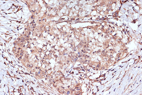 BAG2 Antibody in Immunohistochemistry (Paraffin) (IHC (P))