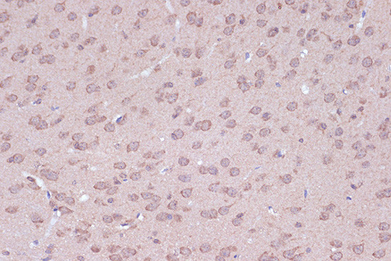 BAG2 Antibody in Immunohistochemistry (Paraffin) (IHC (P))