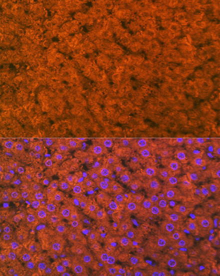 RBP4 Antibody in Immunohistochemistry (Paraffin) (IHC (P))