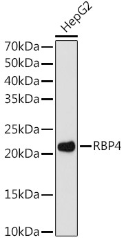 RBP4 Antibody in Western Blot (WB)