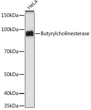 Butyrylcholinesterase Antibody in Western Blot (WB)