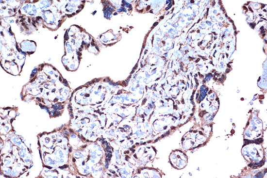 PDCD4 Antibody in Immunohistochemistry (Paraffin) (IHC (P))