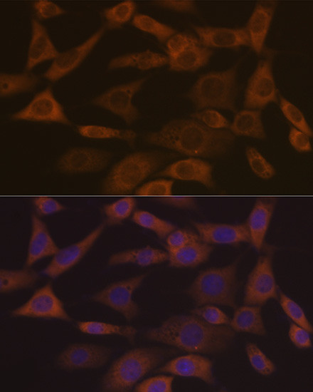 Ephrin A1 Antibody in Immunocytochemistry (ICC/IF)