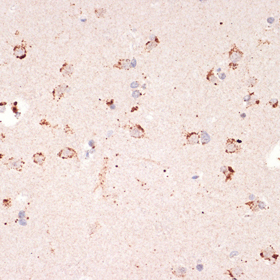 Ephrin A1 Antibody in Immunohistochemistry (Paraffin) (IHC (P))