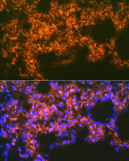 Mesothelin Antibody in Immunohistochemistry (Paraffin) (IHC (P))