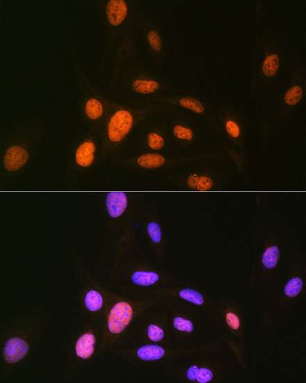 CaMKIV Antibody in Immunocytochemistry (ICC/IF)