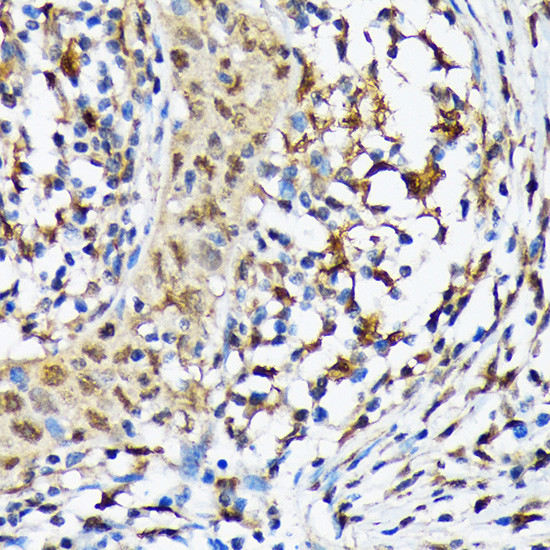 CaMKIV Antibody in Immunohistochemistry (Paraffin) (IHC (P))