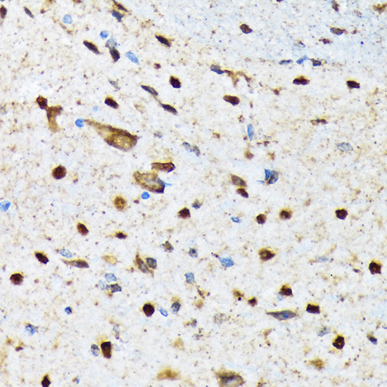 CaMKIV Antibody in Immunohistochemistry (Paraffin) (IHC (P))