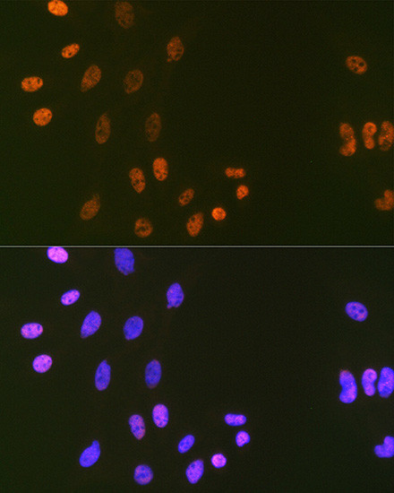 DNA Ligase I Antibody in Immunocytochemistry (ICC/IF)