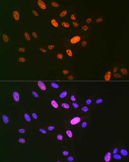 DNA Ligase I Antibody in Immunocytochemistry (ICC/IF)