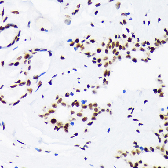 DNA Ligase I Antibody in Immunohistochemistry (Paraffin) (IHC (P))