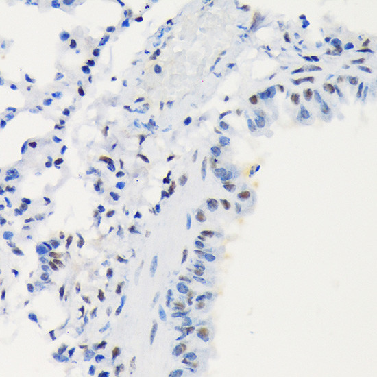 DNA Ligase I Antibody in Immunohistochemistry (Paraffin) (IHC (P))