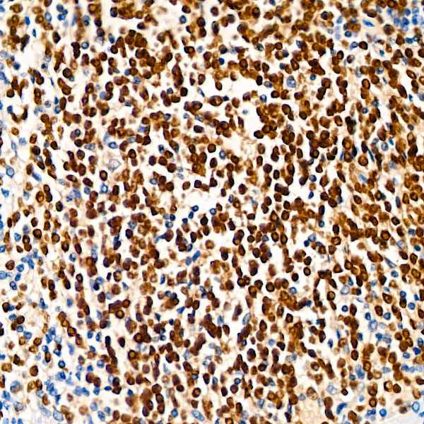 PAX5 Antibody in Immunohistochemistry (Paraffin) (IHC (P))