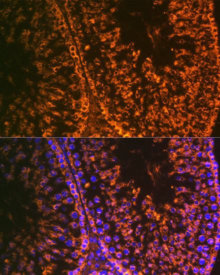 LIN28A Antibody in Immunohistochemistry (Paraffin) (IHC (P))