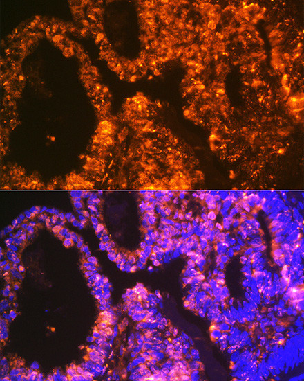 LIN28A Antibody in Immunohistochemistry (Paraffin) (IHC (P))