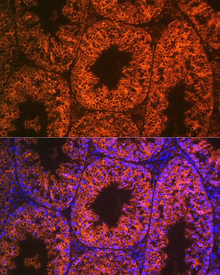 LIN28A Antibody in Immunohistochemistry (Paraffin) (IHC (P))