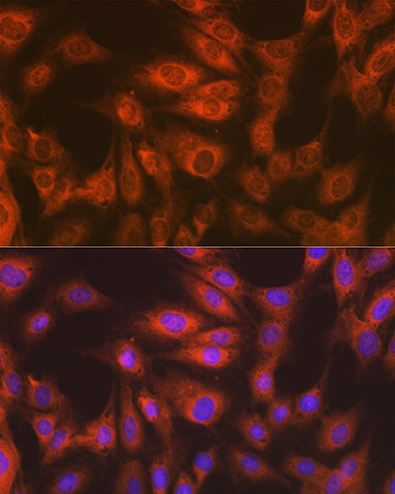 EEF2 Antibody in Immunocytochemistry (ICC/IF)