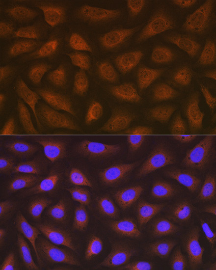 EEF2 Antibody in Immunocytochemistry (ICC/IF)