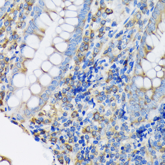 EEF2 Antibody in Immunohistochemistry (Paraffin) (IHC (P))