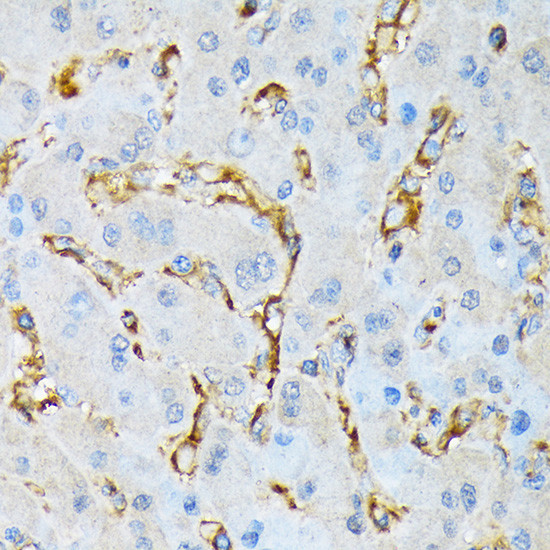 IQGAP1 Antibody in Immunohistochemistry (Paraffin) (IHC (P))