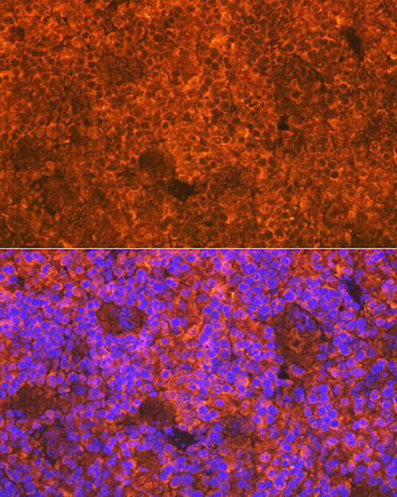 CD3d Antibody in Immunohistochemistry (Paraffin) (IHC (P))